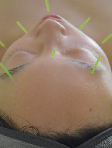 Wellness on Whyte - Facial